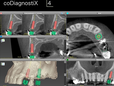 1coDiagnostiX™